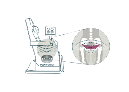PelviPower funktionelle Magnetstimulation für den Beckenboden
